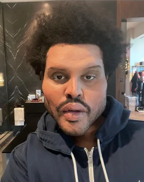 The Weeknd se deforma la cara y aparece con prótesis en pómulos y barbilla en su nuevo vídeo
