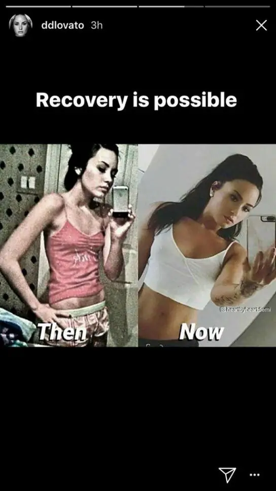 el antes y el después de Demi Lovato con la bulimia